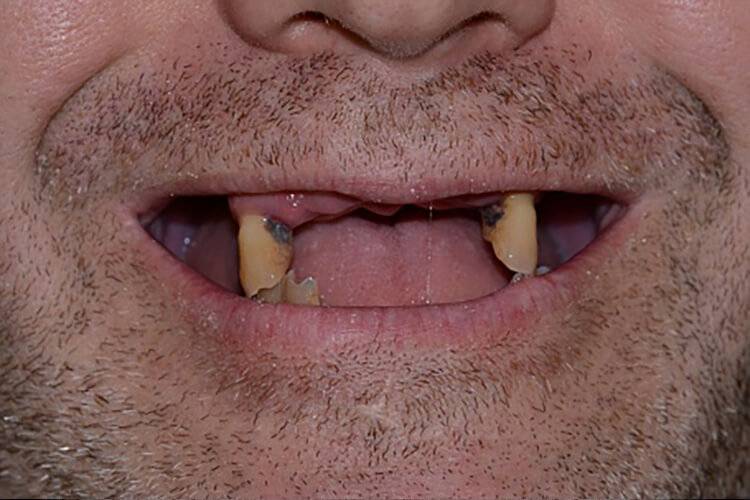do